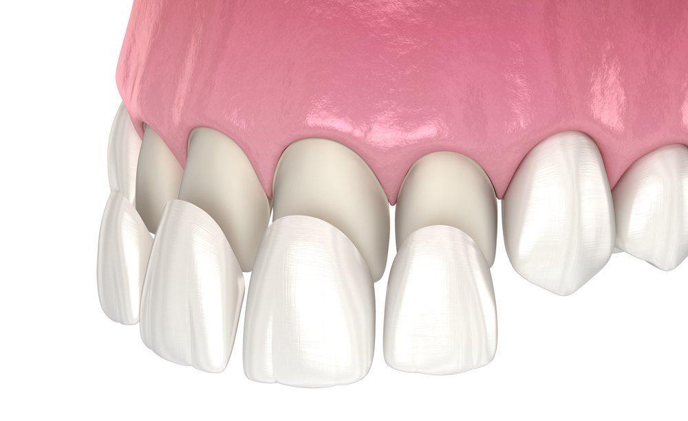 Equipamentos Odontológicos